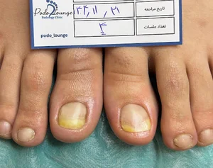 پُدولانژ | مرکز تخصصی مراقبت پا (شعبه زعفرانیه)