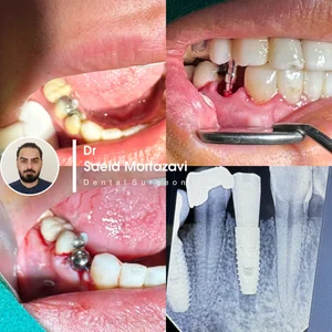 دندانپزشکی دکتر سعید مرتضوی و دکتر فرناز همتی 4