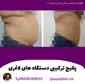کلینیک تخصصی لاغری فروغ شریف ارا 4