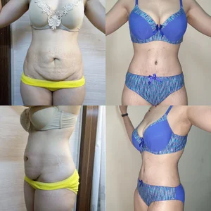 کلینیک زیبایی و پیکر تراشی در مشهد