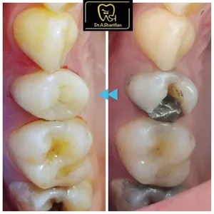 مطب دندانپزشکی دکتر علی اکبر شریفیان 5
