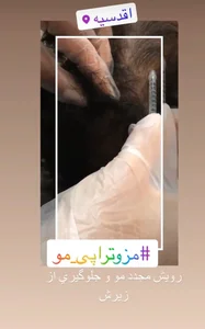 کلینیک پوست و مو و لیزر نیلوفر آبی 4