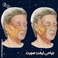 دکتر راضیه جعفری