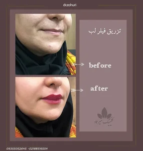 کلینیک زیبایی و جراحی میرعماد 5