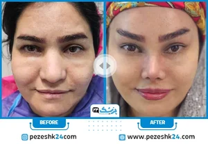 کلینیک مونرو
