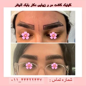 مطب دکتر بابک آذین فر 2