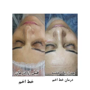 کلینیک پاکسازی وفیشیال پوست آلا بانو 5