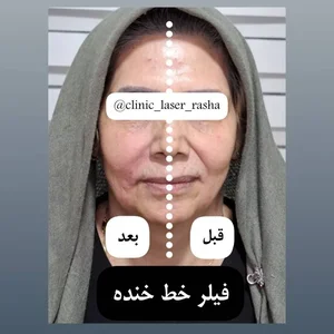 کلینیک لیزر و زیبایی راشا 3