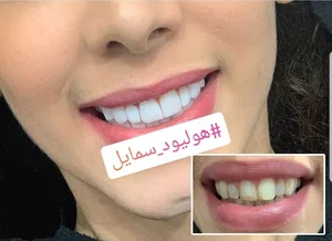 علاج و تجميل في ايران | دانیال طب تور