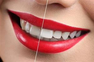 مطب دندانپزشکی دکتر سیده راضیه نوربخش
