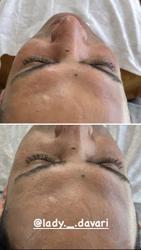 فیشیال و پاکسازی کرمان