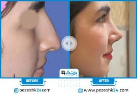 بهترین دکتر جراح بینی در خرم اباد سال ۱۴۰۵ + هزینه