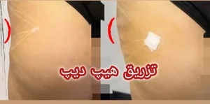 کلینیک تخصصی زیبایی و لیزر موی ابریشم 5