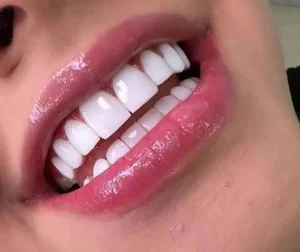 دندانپزشکی دلیار 2