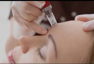 تزریق بوتاکس در شیراز - دکتر راحله نظری