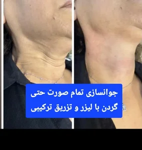 دکتر فروغ نجفی مرکز لیزر و زیبایی 2