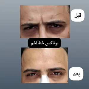 کلینیک لیزر و زیبایی راشا 5