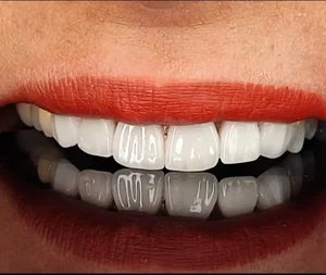 مطب دکتر زهرا خلیلی دندانپزشک