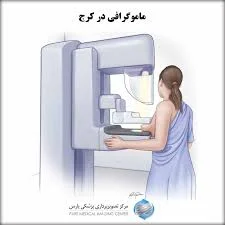 سونوگرافی مینا آقازاده