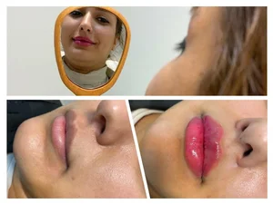 کلینیک لیزر، پوست و مو، فرجام 3