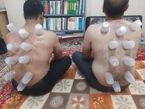 حجامت درمانی 3
