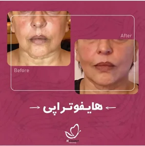 کلینیک میمنت 5