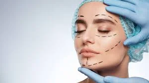 عمل زیبایی بینی - دکتر مهدی هاشمی