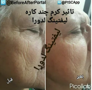 آکادمی لدورا