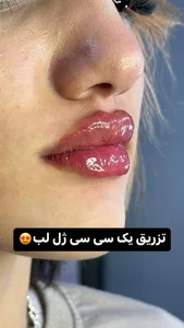 کلینیک پوست،زیبایی و لیزرماریسا 5