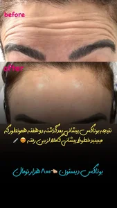مرکز لیزر و کلینیک زیبایی پریفا 2