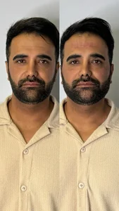 مجموعه پوست و مو زیبایی دلدار 2