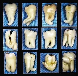 دندانپزشکی و دندانسازی
