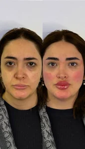 مجموعه پوست و مو زیبایی دلدار 5