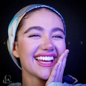 دندانپزشکی آکوپی 4