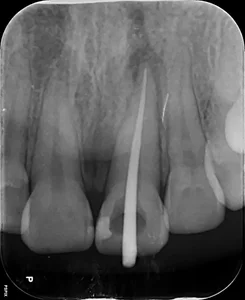 رادیولوژی دهان.فک و صورت ویرا Veera OMF Center Radiology