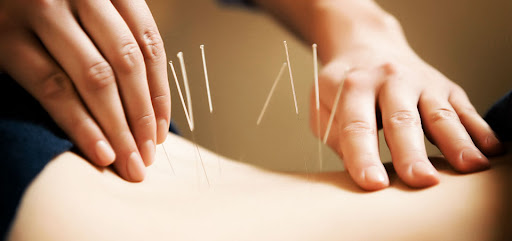 طب سوزنی دکتر مهسا سلیمی