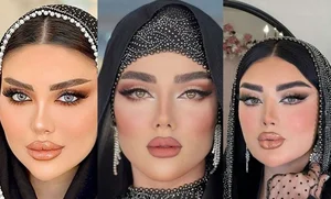 پیرایش موکات - قم - 5626