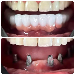 دندانپزشکی دکتر پدرام عبداله زاده 3