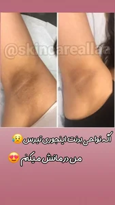 کلینیک پاکسازی وفیشیال پوست آلا بانو 2