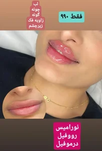 @Dr_laser_gorgan کلینیک لیزر و زیبایی نیوشا