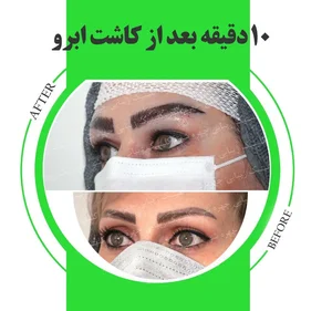 کلینیک زیبایی چهره شو 4