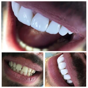 مرکز دندانپزشکی و دندانسازی نکو 5