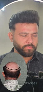 موسسه پروتز مو افلاک مشهد