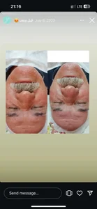 خدمات تخصصی پوست و مو مریم نصیرپور 2