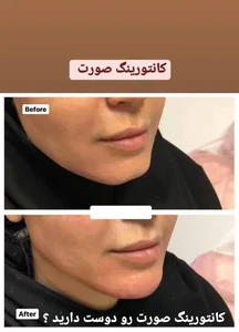 مطب زیبایی سلین