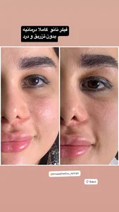 مرکز پوست و لیزر شیما
