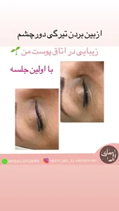 بیوتی تراپیست الهه حصاری 3