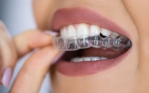 دکتر فرزاد یحیی پور متخصص ارتودنسی