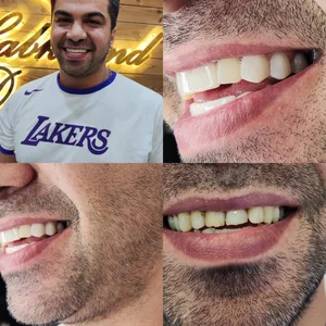 دندانپزشکی لبخند 4