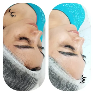 فیشیال و پاکسازی پوست ندا 2